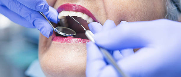 Best Knocked-Out Tooth (Avulsed Tooth) Treatment in Minerva Park, OH